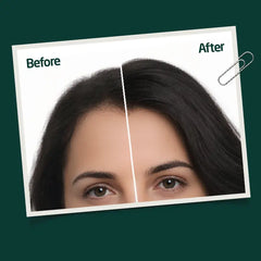 Reroot Hair Growth (Spray and Tablet Pack)